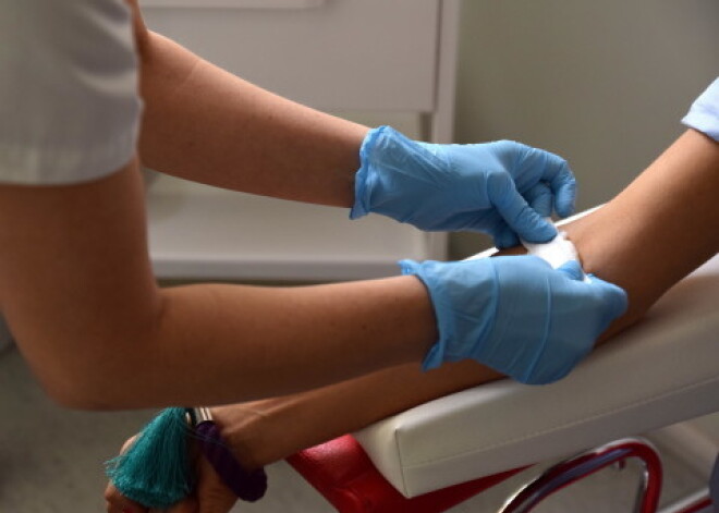 В прошлом году зарегистрировано 326 новых случаев ВИЧ, в том числе у пяти новорожденных