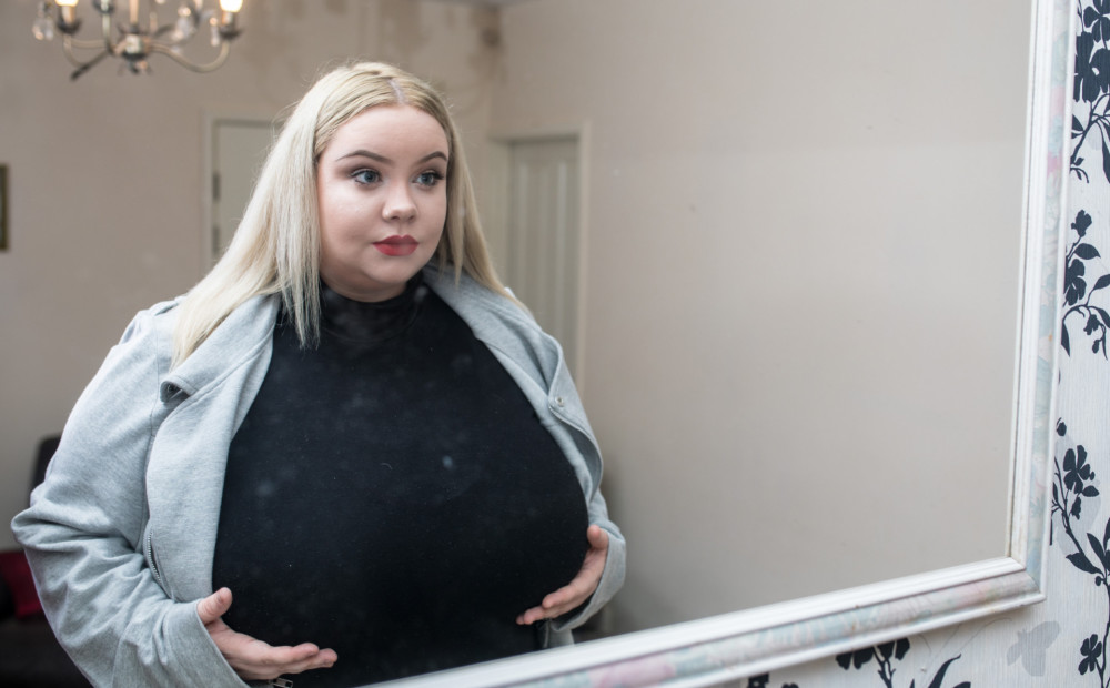 Огромная грудь 35-летней женщины весит 12 кг и продолжает расти: фото