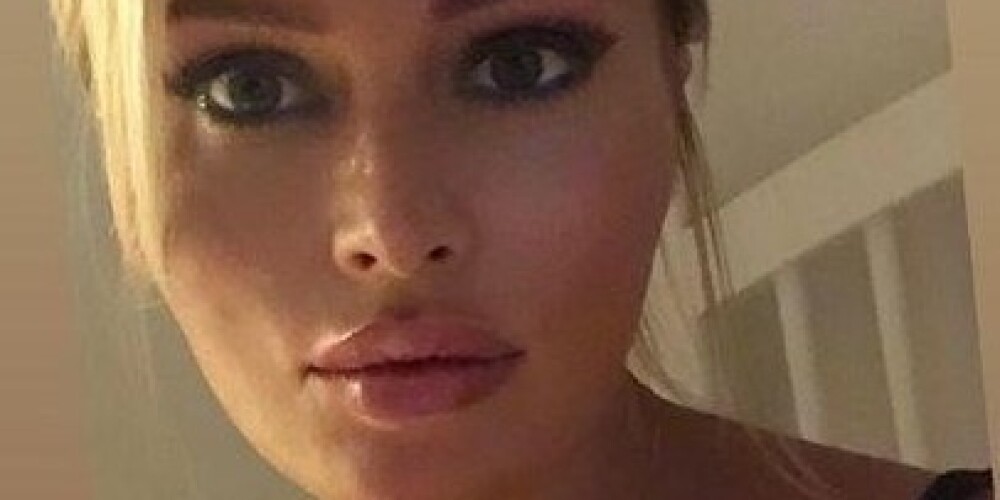 Дана Борисова попросила поклонников оценить ее новые губы