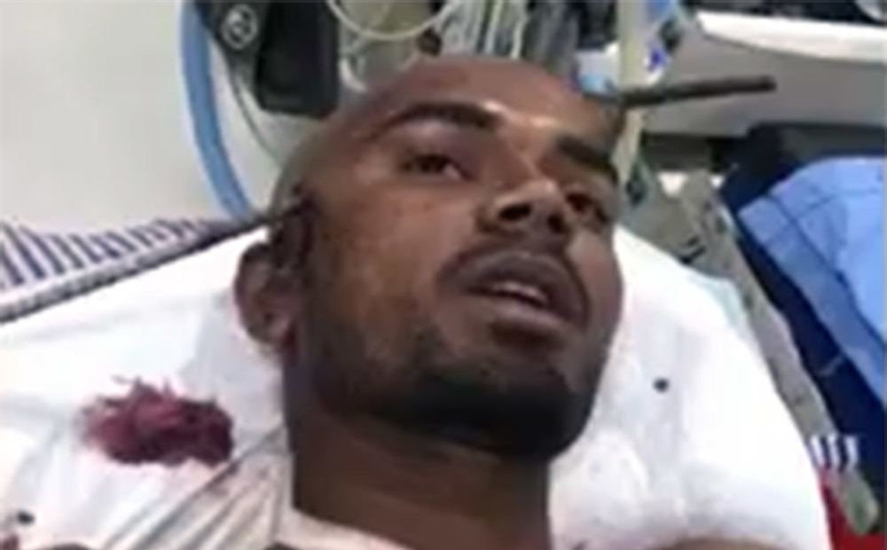 VIDEO: celtnieks izdzīvo pēc šausminoša incidenta - viņa galvu caurdūra metāla stienis