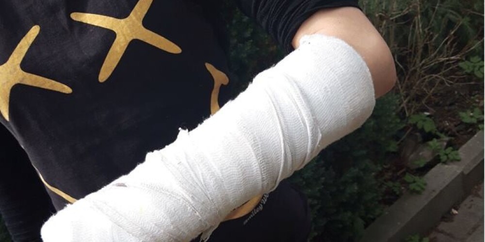 Юрмальчанка возмущена: ее маленькая дочь сломала руку из-за хулиганской выходки подростков