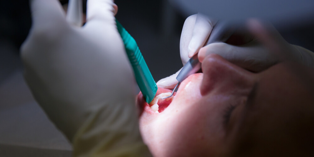 Smaganu saslimšana, kuras rezultātā var izkrist zobi un palielināties cukura diabēta risks - ārsti iesaka to ārstēt nekavējoties