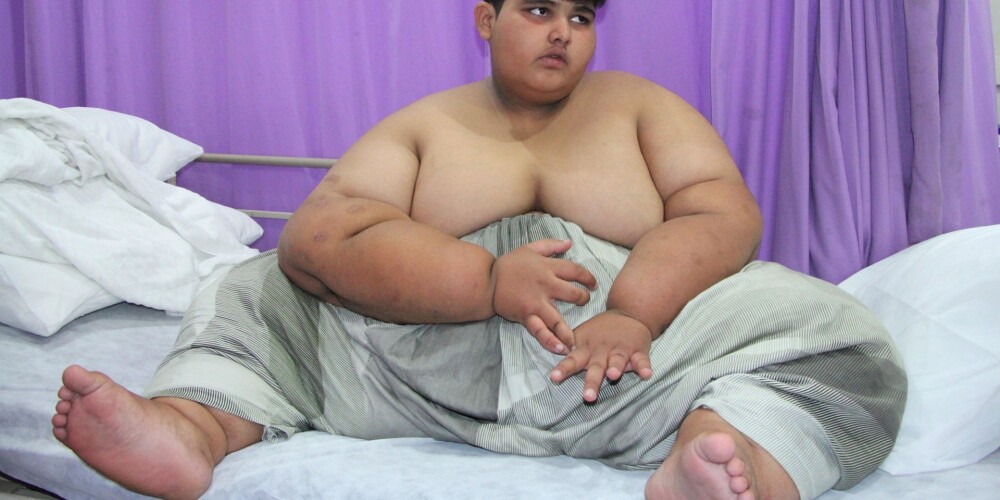 10 gadus vecais Muhameds ir resnākais zēns uz pasaules - viņš sver 196 kilogramus