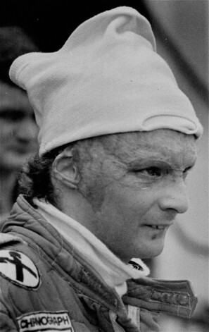 Nikijs Lauda 1977.gadā.