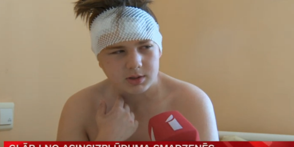 Tikai 13 gadu vecajam Danielam Stradiņos no smadzenēm izoperēta "bumba ar laika degli"