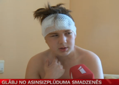 Tikai 13 gadu vecajam Danielam Stradiņos no smadzenēm izoperēta "bumba ar laika degli"