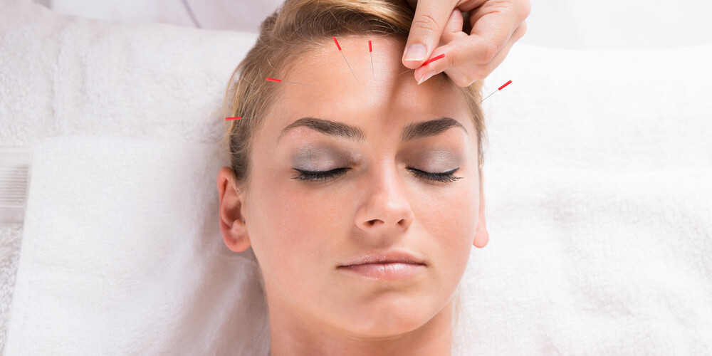 Akupunktūra skaistumkopšanā - tā sola botoksa efektu bez rētām. Vai tiešām tā spēj aizstāt regulāru kosmetologa apmeklējumu?