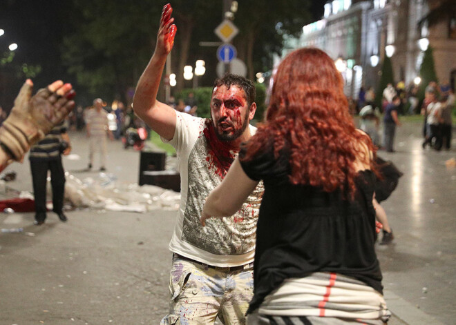 Protestos pie Gruzijas parlamenta cietuši 240 cilvēki, divi protestētāji zaudējuši acis