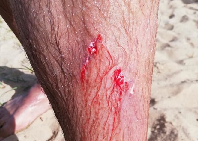 Aculiecinieks par briesmām Ozolnieku ezerā: "Esiet uzmanīgi, neņurkojiet!"