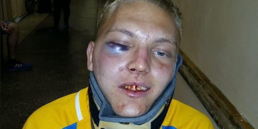 Skandāls Krievijā: futbolists ar salauztu žokli spiests apbraukāt 3 slimnīcas, lai saņemtu palīdzību