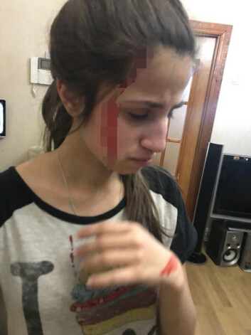 Раненая Ангелина отцом сообщила об этом своему брату Арсену
