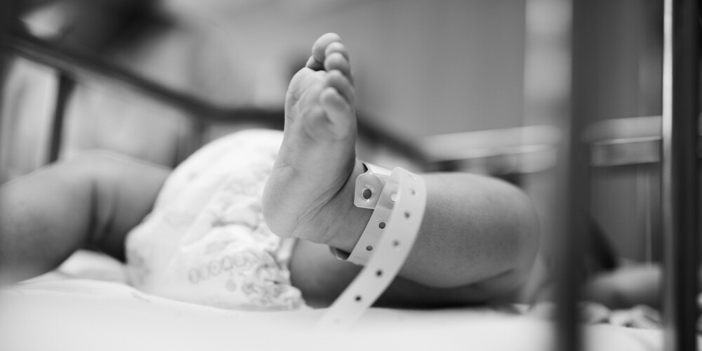 Vecāki Itālijas slimnīcā pametuši zīdaini, kurš piedzimis ar retu ādas slimību