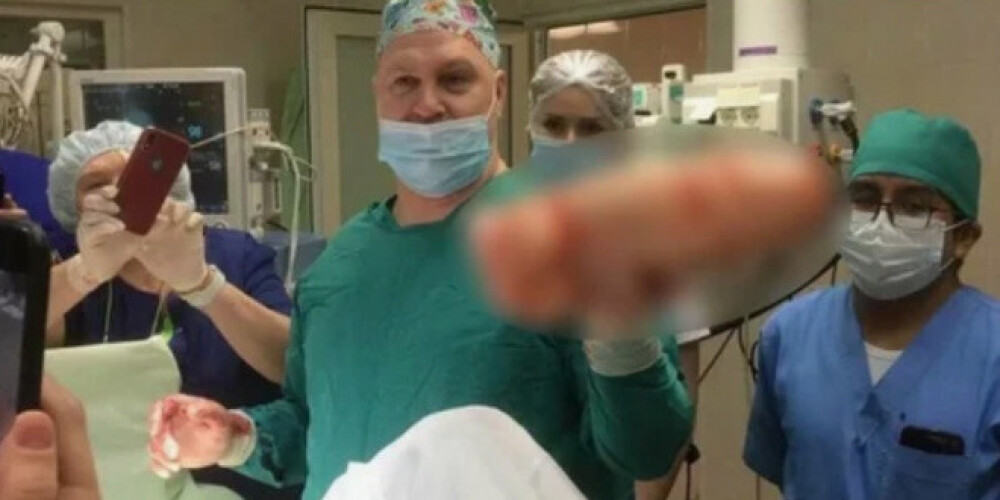 Хирурги спасли мужчину от гигантского фаллоса, но теперь их ждут проблемы