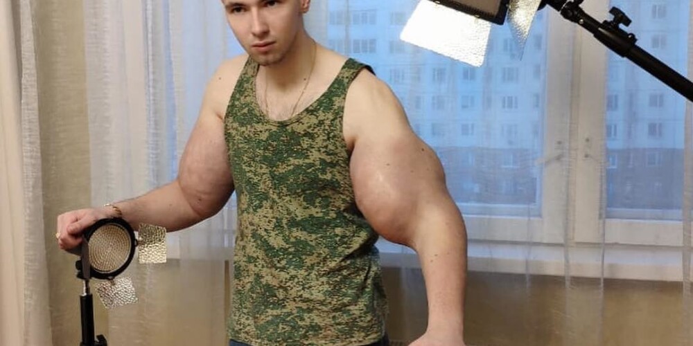 "Руки-базуки" Кирилл Терешин показал, как выглядит после операции