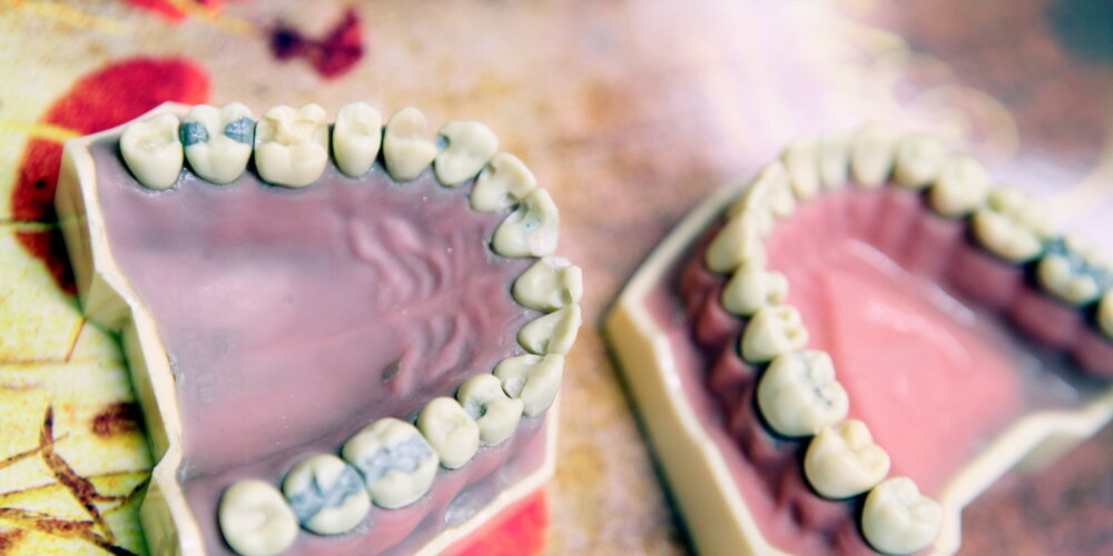 ASV Veselības ministrija nāk klajā ar pārsteidzošu paziņojumu par zobu diegošanu