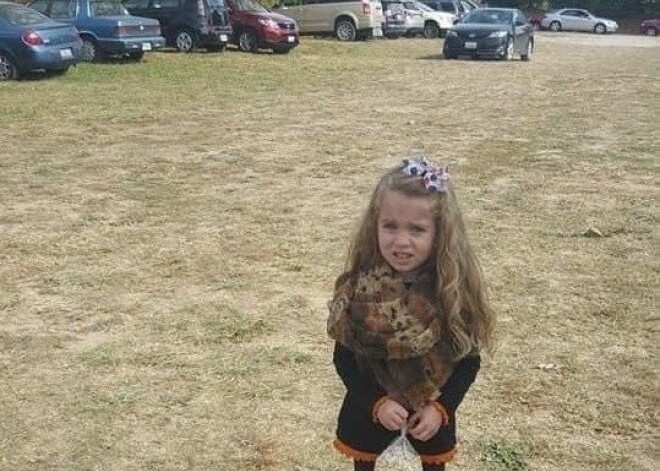 Ne viss ir tā, kā izskatās: meitene ar nedabiski tievām kājām samulsina sociālo tīklu lietotājus