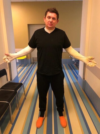 Šis laiks Artusam Kaimiņam ir īpaši briesmīgs – guvis roku apdegumus un palicis bez dzīvokļa un visas iedzīves, notikušo ļoti pārdzīvo arī viņa radinieki.