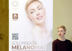 Melanomas paciente Sondra Zaļupe.