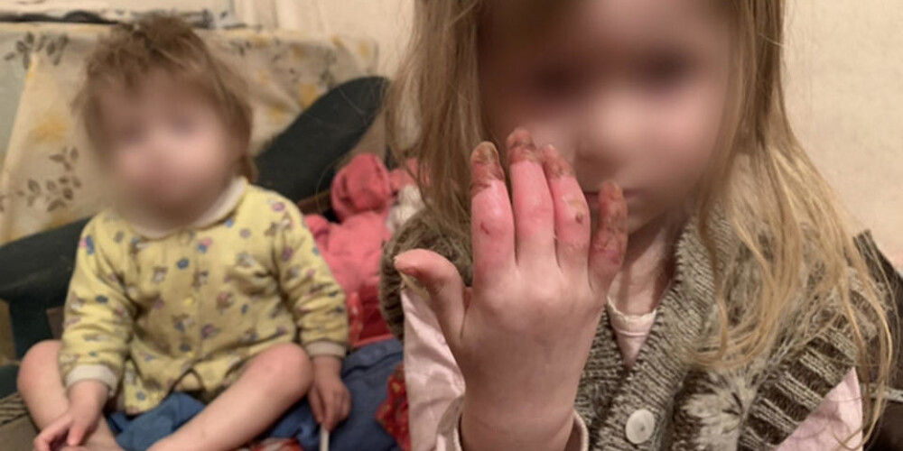У 27-летней матери изъяли голодных детей с обмороженными руками
