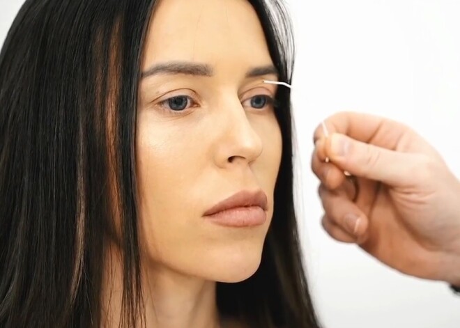 Звезда "Дома-2" Татьяна Строкова рассказала о последствиях блефаропластики