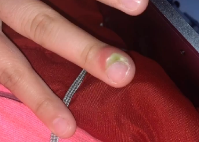 Пугающий рассказ студентки об опасности грызть ногти привлек миллионы людей