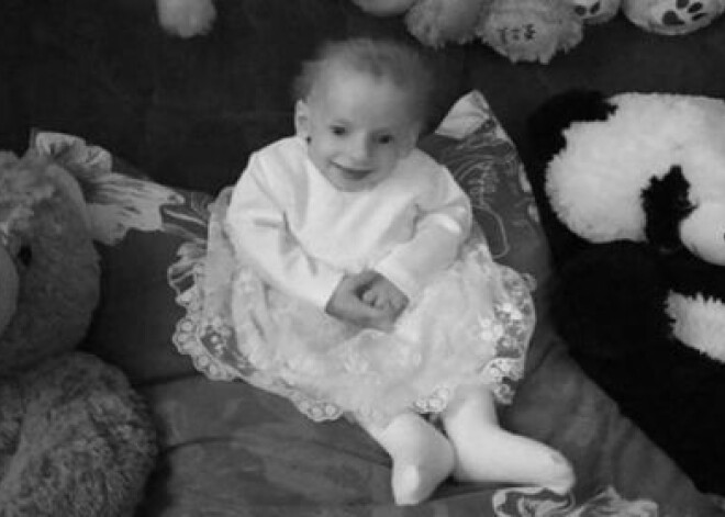 Редкая патология: маленькая девочка состарилась до 80 лет и умерла