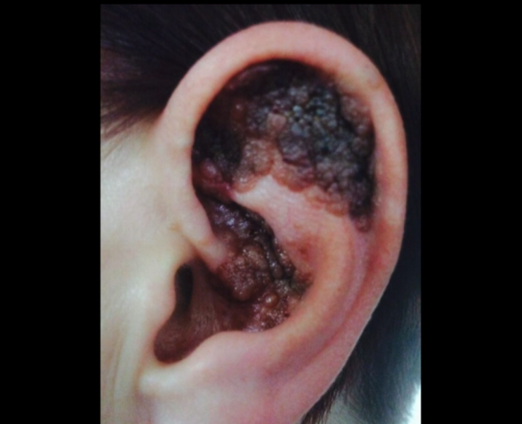Так выглядело ухо Смит перед удалением