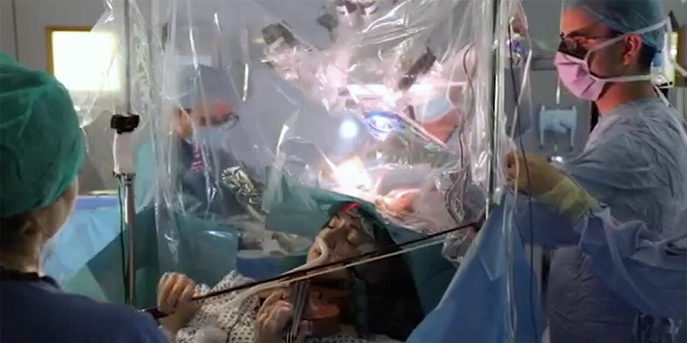 Smadzeņu audzēja operācijas laikā mediķi pamodina pacienti un liek viņai spēlēt vijoli