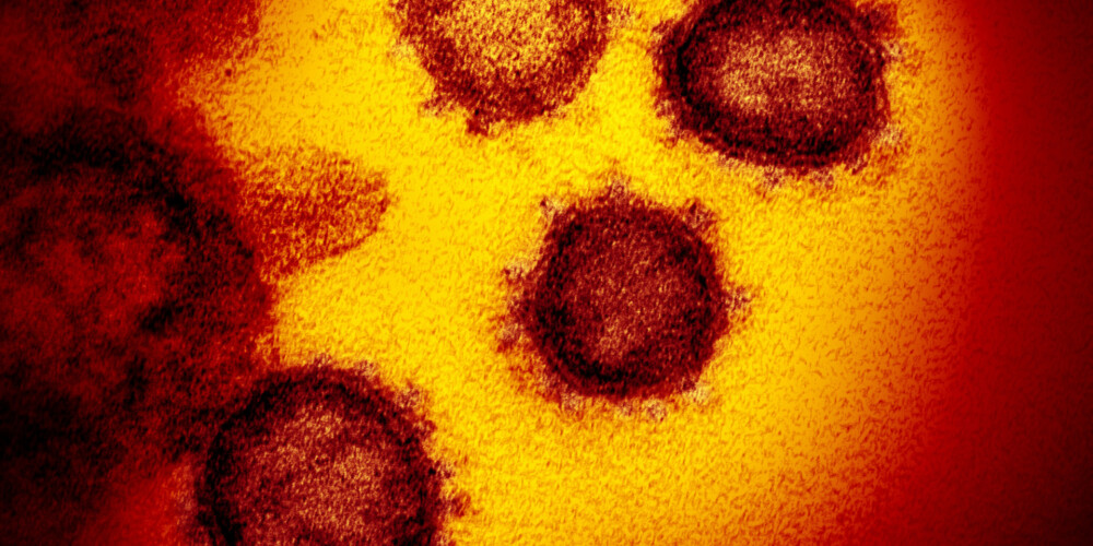 Cik ilgi koronavīruss reāli spēj izdzīvot uz virsmām?