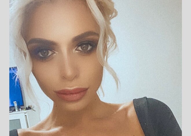 "Столько крови шло": звезда "Дома-2" Анастасия Балинская перенесла операцию на ушах