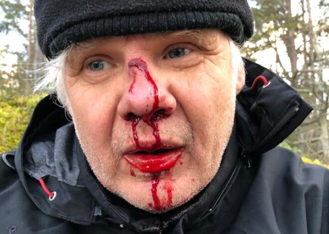 Klapkalnciemā piekauj Zaļās partijas aktīvistu: viņš vēlējās nostrostēt mazgadīgu kāpu postītāju