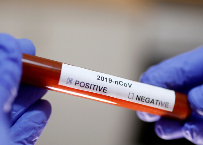 У рижанки, переболевшей коронавирусом, повторные анализы вирус не показали