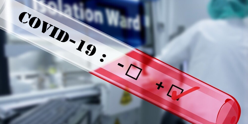COVID-19, ранее коронавирусная инфекция 2019-nCoV— потенциально тяжёлая острая респираторная инфекция, вызываемая коронавирусом SARS-CoV-2 (2019-nCoV). Представляет собой опасное заболевание, которое может протекать как в форме острой респираторной вирусной инфекции лёгкого течения, так и в тяжёлой форме. Наиболее частым осложнением заболевания является вирусная пневмония, способная приводить к острому респираторному дистресс-синдрому и последующей острой дыхательной недостаточности, при которых чаще всего необходимы кислородная терапия и респираторная поддержка. К наиболее распространённым симптомам заболевания относятся повышенная температура тела, утомляемость и сухой кашель. В редких случаях поражение вирусом детей и подростков, предположительно, может приводить к развитию воспалительного синдрома