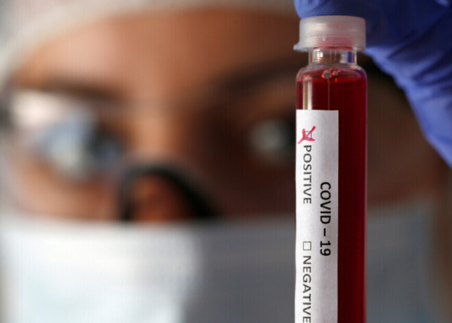 Двое из 11 заболевших "Covid-19" за последние сутки заразились в Латвии