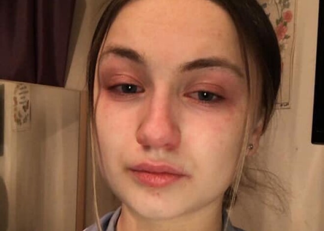 «Я напугана. Думаю, ситуация будет ухудшаться». Работающая по 13 часов в день медсестра рассказала о муках зараженных пациентов