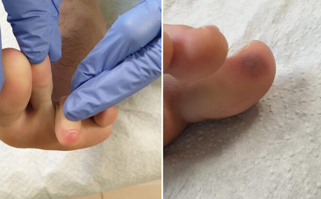 Mediķi iesaka pievērst uzmanību savu kāju stāvoklim.