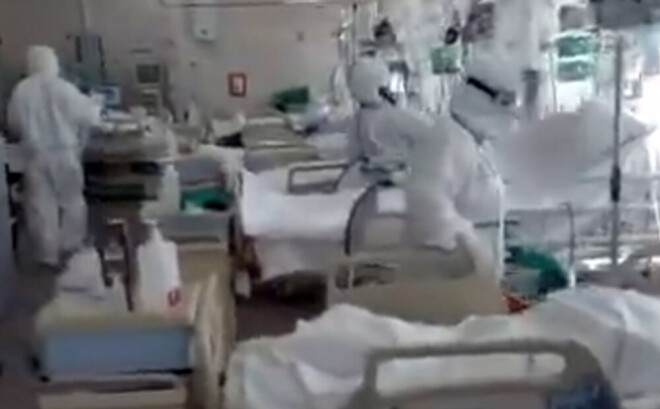 Daudziem pacientiem nepieciešama mākslīgā plaušu ventilācijas sistēmas.