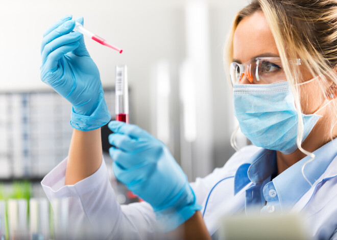 Сдай анализы на старение: как помочь своему организму оставаться молодым