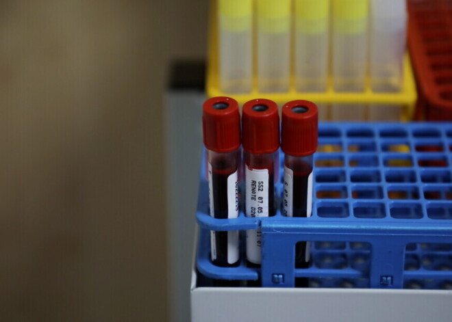 За прошедшие сутки выявлено 16 новых случаев Covid-19