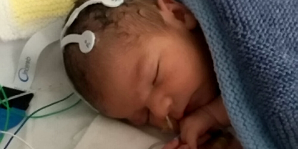 Britu puisēns Oskars kļūst par pirmo eksperimentālo mazuli, kura ārstēšanai slimnīcā izmanto kaņepju medikamentu