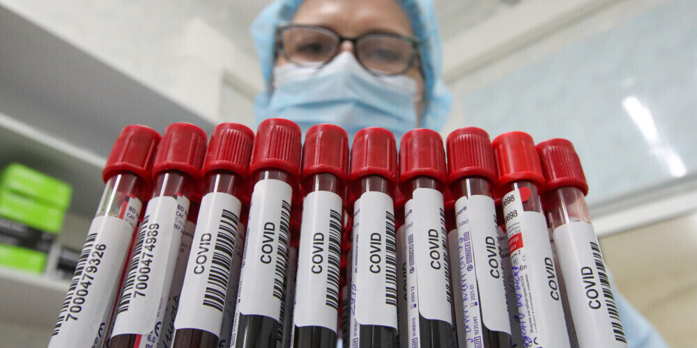 В Латвии можно сдать тест на антитела к Covid-19: нужно ли это делать?
