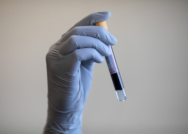 Pagājušās diennakts laikā stacionēti divi Covid-19 pacienti, inficēšanās konstatēta vienam cilvēkam