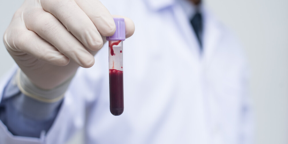 Covid-19 infekcijas smagums atkarīgs no asins grupas