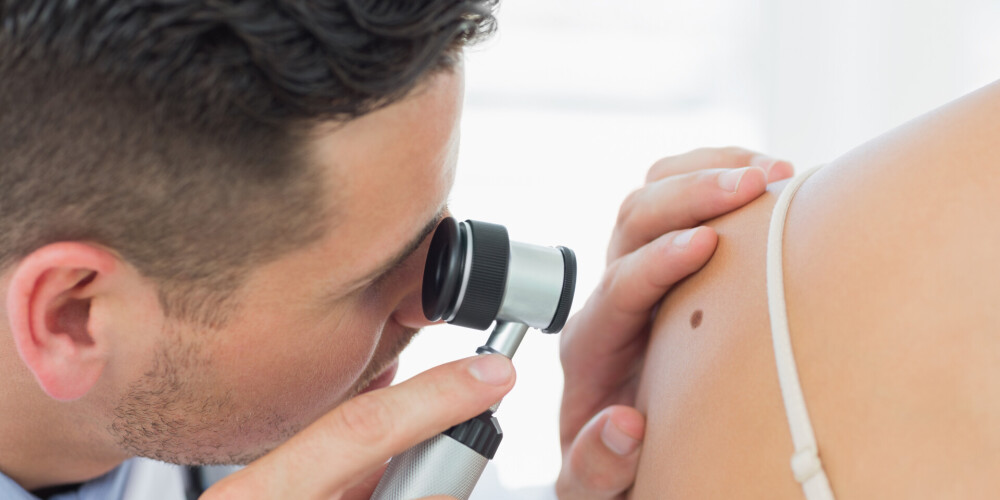 Опасные симптомы: какие новообразования на коже могут сигнализировать о раке
