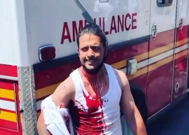 Абсолютно спокойный парень с ножом в голове удивил Сеть