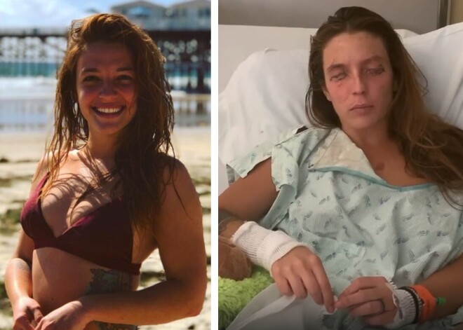 Девушка случайно сожгла себе глаза и осталась слепой, пытаясь сделать косметику в домашних условиях