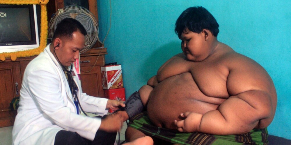 Феноменально! Как самый толстый мальчик в мире выглядит после похудения на 110 кило и удаления лишней кожи