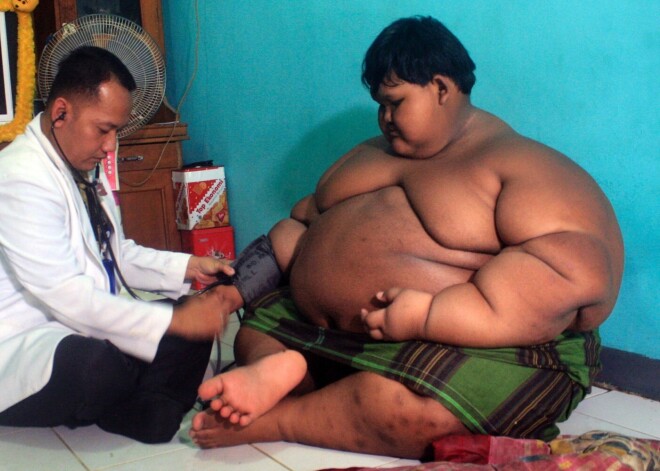 Феноменально! Как самый толстый мальчик в мире выглядит после похудения на 110 кило и удаления лишней кожи