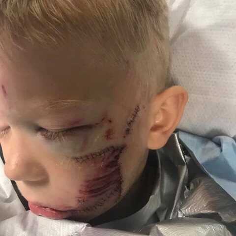 «Если кто-то должен был умереть, это должен быть я»: 6-летний мальчик спас сестренку от собаки