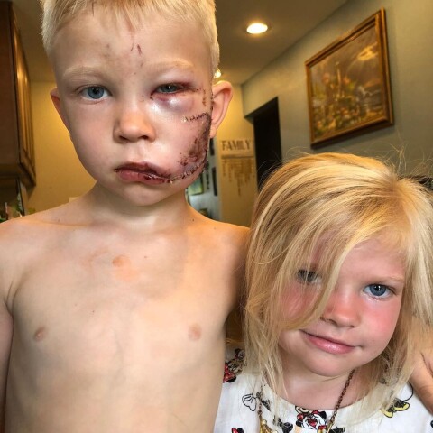 «Если кто-то должен был умереть, это должен быть я»: 6-летний мальчик спас сестренку от собаки